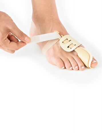 Hallux valgus splint